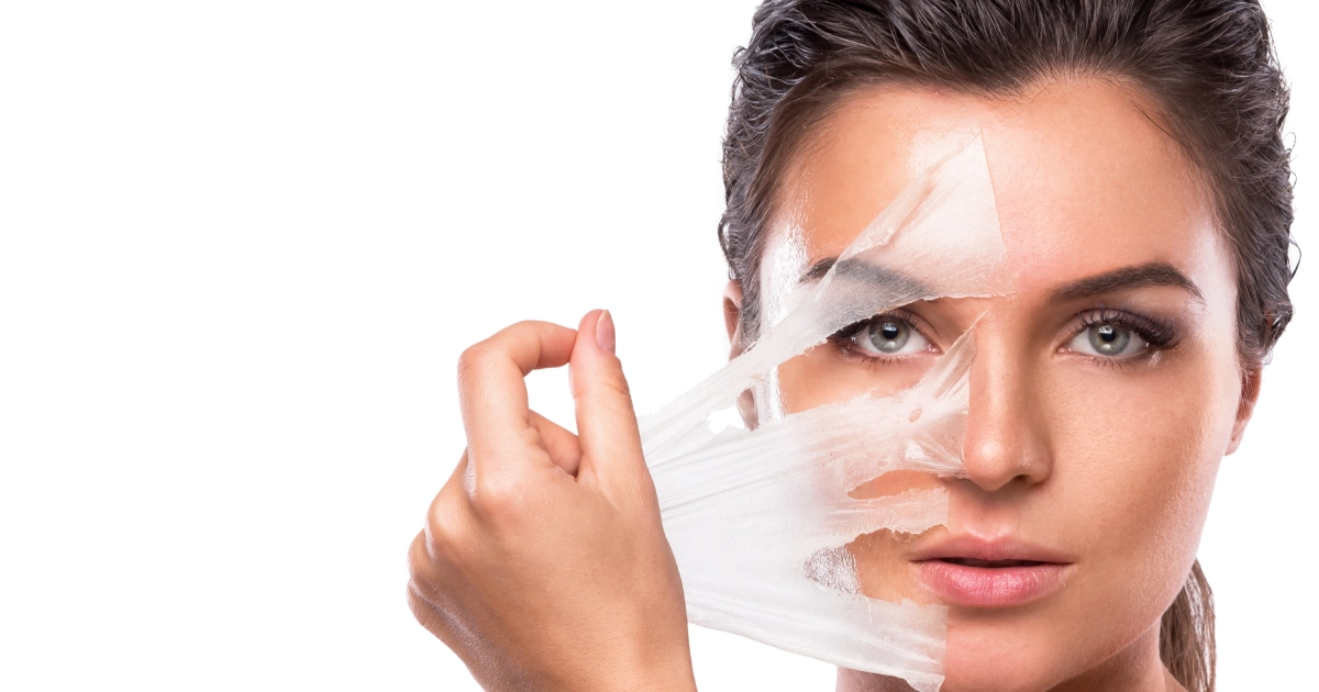 Beautiful woman removing a peel-off mask, featuring the ZO 3-Step Peel in Raleigh, NC