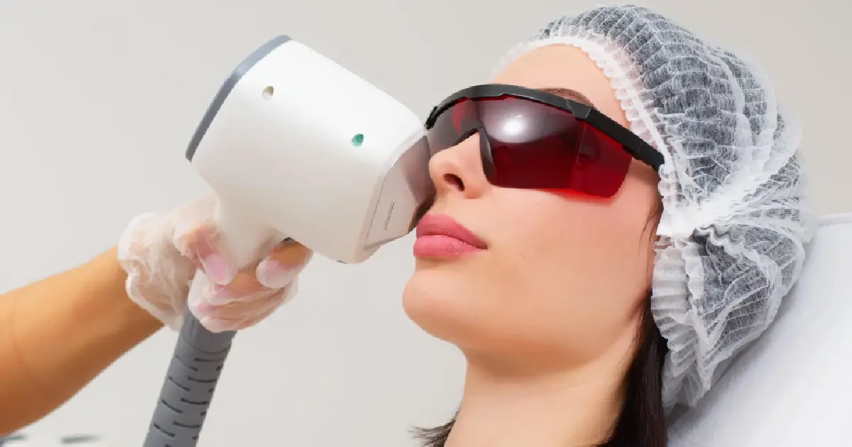 SkinTyte BBL Treatment in Raleigh, NC